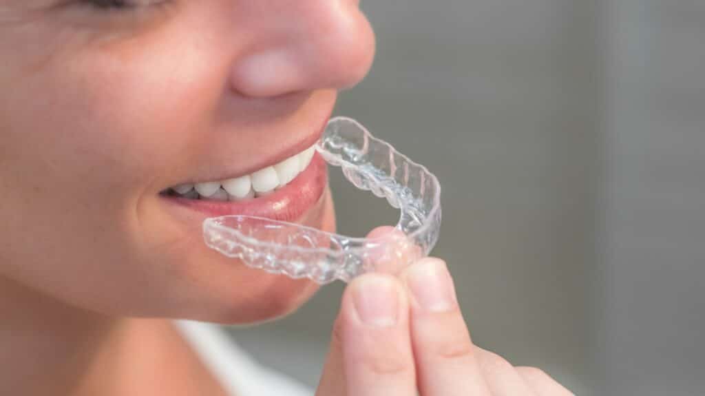 Invisalign Orthodontist in Blue Springs