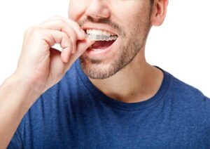 Invisalign orthodontist in Blue Springs