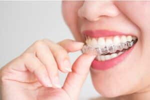 Invisalign Orthodontist in Blue Springs
