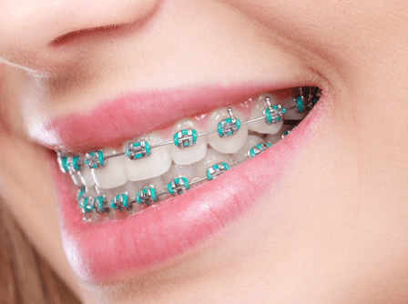 Orthodontist in Mission
